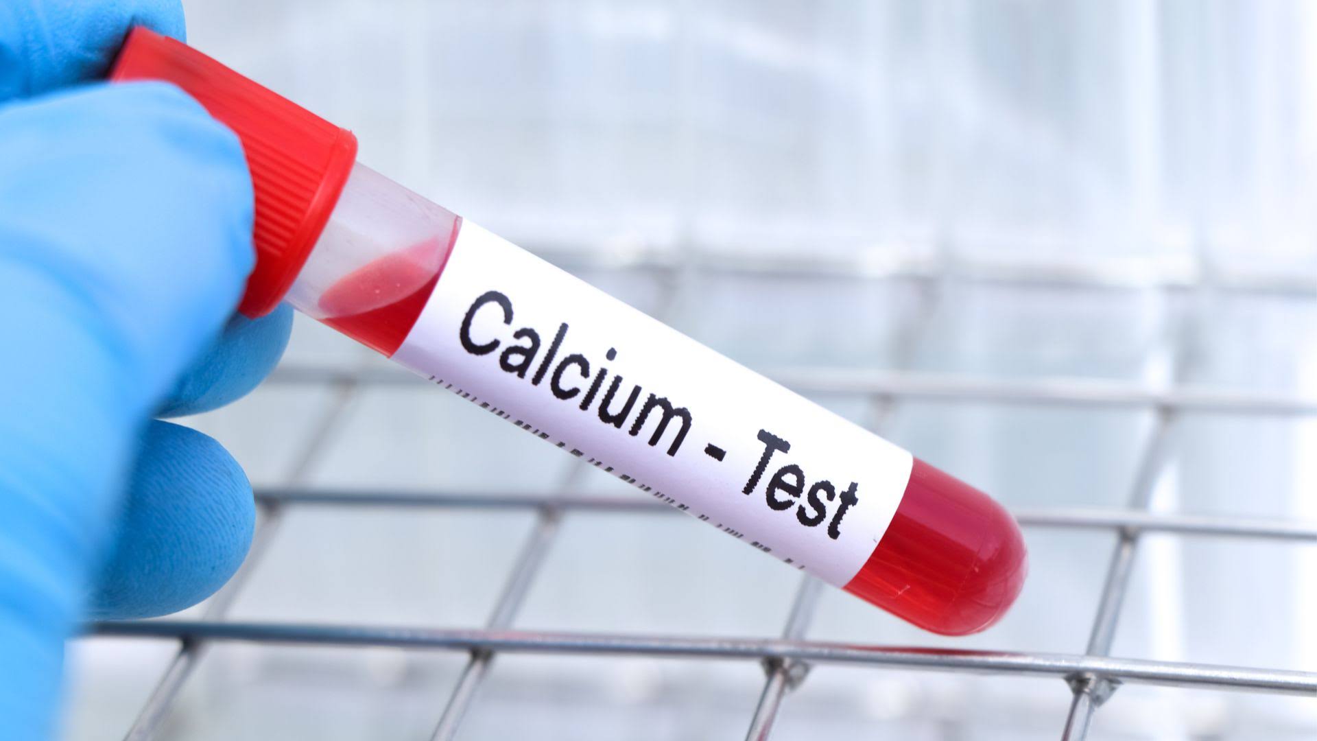 CALCIUM product image