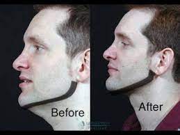 I do not have a strong jaw. How To Get A Good Jawline Stronger Jawline 5 Tips For A Good Jawline For Men Youtube