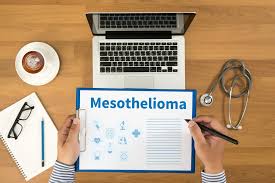 Ask your doctor about participating in a clinical trial if you have a mesothelioma diagnosis. Best Mesothelioma Doctors Medical Care Belluck Fox Llp