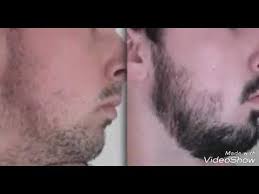 It may help strengthen the roots of your hair while nourishing your hair follicles. Before And After Of Beard Using Black Castor Oil Youtube