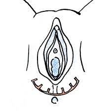 Eine anleitung und tipps zur richtigen anwendung. á… Dammmassage Eine Genaue Anleitung