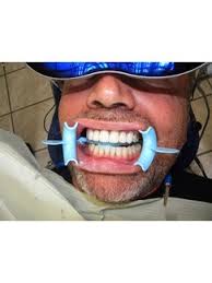 3-Unit Bridge in Heredia, Costa Rica • Check Prices & Reviews