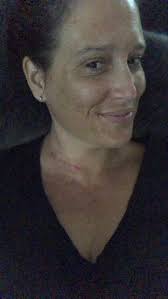 Positive social media comments as therapy