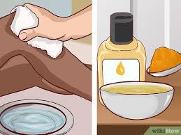 Cara menghilangkan jerawat bisul memang tidak bisa sembarangan. 3 Cara Untuk Menghentikan Pertumbuhan Bisul Berulang Wikihow