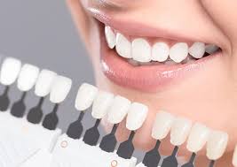 Costa mesa dentist specializing in full dental care. Teeth Whitening Bossley Park Dentist Gladesville Dentist Dental Pro