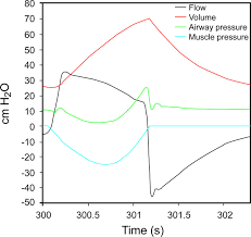 Should A Tidal Volume Of 6 Ml Kg Be Used In All Patients