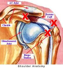 Your shoulder is made up of three bones: Pin On Fitness Motivation
