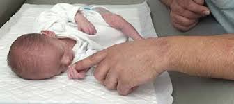 Los Recien Nacidos Con Bajo Peso De Caracter Leve Presentan Inmadurez Neurologica Hospital Clinic Barcelona