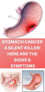Stomach cancer often does not have symptoms in the early stages. Pin On Healthysolutions24 Com