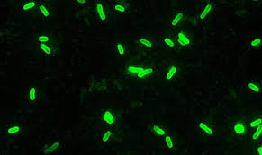 Von wann bis wann ging das hochmittelalter? Wie Die Pest Aus Europa Verschwand Forscher Rekonstruieren Verlauf Und Eindammung Der Letzten Pest Epidemie Auf Unserem Kontinent Scinexx De