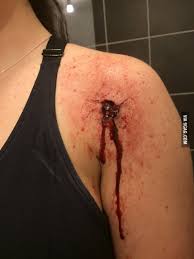 50 caliber gunshot wound : Ydntn 9gag