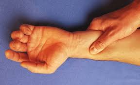 It's most commonly caused by. Pressure On The Volar Forearm Shortens The Tendons And Will Flex Digits Download Scientific Diagram