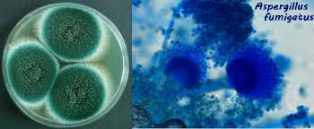 Aspergillus Fumigatus Microbiology Fungi Electron Microscope
