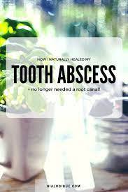 How I Naturally Healed A Tooth Abscess And Avoided A Root Canal Procedure Remedies For Tooth Ache Root Canal Remedies