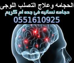 سرطان الدماغ نمو غير طبيعي للخلايا في الدماغ. Ø§Ù„Ø­Ø¬Ø§Ù…Ù‡ Ù„Ø¹Ù„Ø§Ø¬ Ø­Ø¬Ø§Ù…Ù‡ Ù†Ø³Ø§Ø¦ÙŠÙ‡ Ø¨Ø¬Ø¯Ù‡ Ø§Ù… ÙƒØ±ÙŠÙ…Ù Ù¥Ù¥Ù¡Ù¦Ù¡Ù Ù©Ù¢Ù¥ Facebook