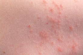 Pin On Baby Skin