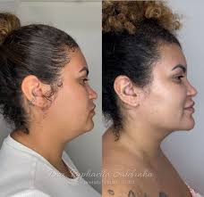 Dra Raphaella Saldanha (@dra.raphaellasaldanha) • Фото и видео в Instagram