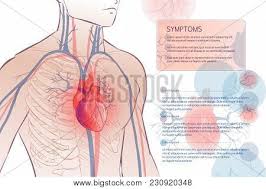 She was in the hospital, having a lump removed from her breast. 3d Illustration Human Vector Photo Free Trial Bigstock