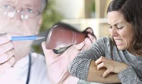 He was a partner at dipiero simmons mcginley & bastress pllc in charleston. Sean Lock Health Comedian Explains Skin Cancer Symptoms And Signs Include Black Patch Express Co Uk