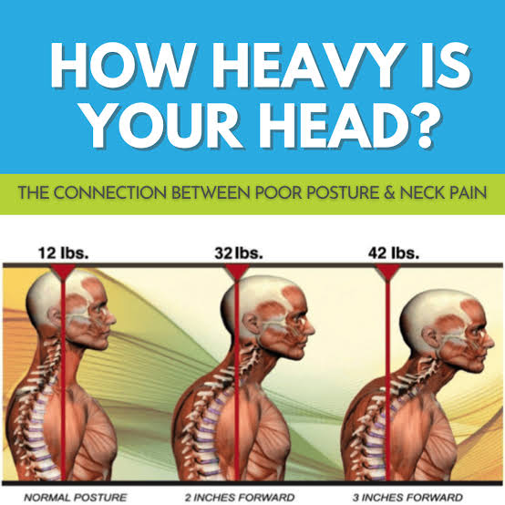 फॉरवर्ड हेड पोस्चर (Text Neck) का प्रभाव, AI generated