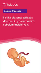 Pertanyaan ini mungkin akan dipertanyakan bagi banyak perempuan khususnya calon ibu. Keputihan Bisa Menjadi Tanda Tanda Mau Melahirkan