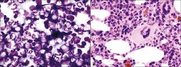Your veterinarian will be able to diagnose low red cell, white cell and platelet levels with a routine blood test. Disorders Of Bone Marrow Veterian Key