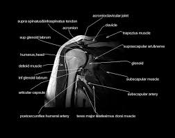 Common questions and answers about foot anatomy mri. Mri Shoulder Anatomy Shoulder Coronal Anatomy Free Cross Sectional Anatomy Shoulder Anatomy Diagnostic Imaging Shoulder Joint Anatomy