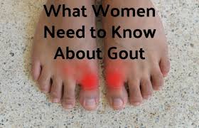 What Women Need To Know About Gout Rocky Mountain Foot And Ankle Gout Gout Symptoms What Is Gout