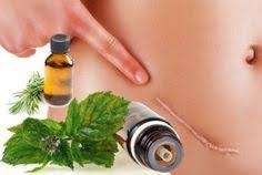 Les 10 Huiles Essentielles Pour Realiser Vos Massages Anti Cicatrices Huiles Essentielles Huile Essentielle Cicatrisante Huiles Essentielles Pour Maigrir