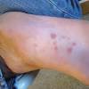 Syphilis is a sexually transmitted infection caused by the bacterium treponema pallidum subspecies pallidum. Https Encrypted Tbn0 Gstatic Com Images Q Tbn And9gcsageqfsbiap2i7jsd Lowhrfbkp0ug5bbwubbtgyunydvycjm3 Usqp Cau
