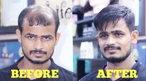 Hair salon near me is your, fast, easy and free custom search engine for finding just the right hair salon in your local area. Best Hair Patch Wig Video In India Stylish Hair Cut By Master Rizy 9582581323 Youtube