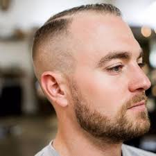 Kurz Fade Defined Teil Frisuren Fur Haarausfall Manner Haarausfall Manner Frisur Geheimratsecken Frisuren Bei Haarausfall