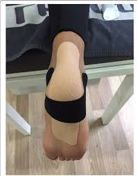 Image result for Taping for Soleus and Achilles