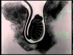 There are no innocuous line drawings but rather abundant nudity. Your Body During Adolescence Female And Male Puberty Sexual Edudcation Movie 1955 Youtube