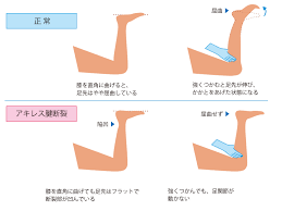 ザムスト