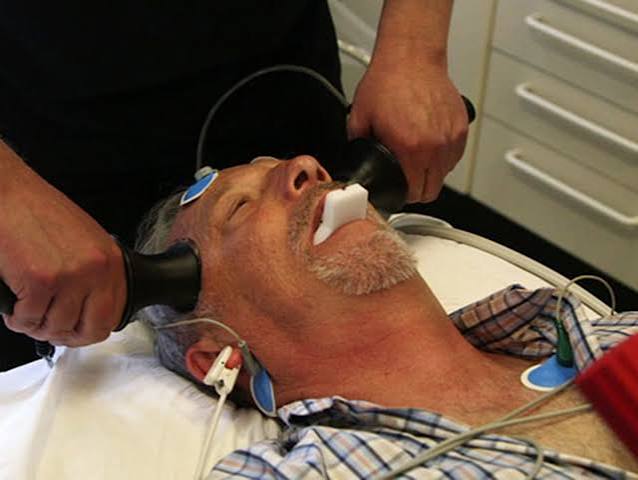 Electroconvulsive therapy is still being used today – with mixed results |  The Independent | The Independent