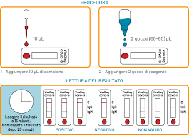 Il test sierologico ha quindi una validità temporanea. Kit Test Sierologico Rapido Covid 19 Igm Igg Sunmedical