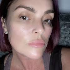 Mum who had constant sniffles has to have entire nose cut off in ultra rare  procedure