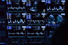 Sinnvoll ist dies auch bei einer herzmuskelentzündung. á… Ultraschall Kardiologische Praxis Dr Morschheuser In Kiel