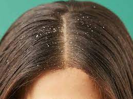 The way white vinegar for hair works is that it balances your hair and scalp ph. Get The Scoop On White Vinegar For Hair Before You Re Too Late Lewigs