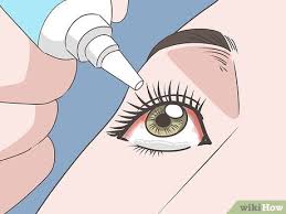 Safe And Effective Ways To Heal A Popped Blood Vessel In Your Eye