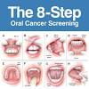 Oral cancer, also known as mouth cancer, is cancer of the lining of the lips, mouth, or upper throat. 1