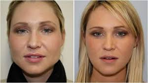 How can face exercises make your face slimmer? Pin On I Love It