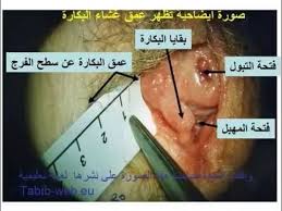 كيف اقوم بفحص غشاء بكارتي في البيت Youtube