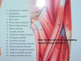 The Anterior Hip Replacement Procedure Is Available In Scottsdale Arizona Dr Stuart Kozinn Is An Exper Hip Replacement Total Hip Replacement Hip Precautions