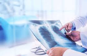 Early lung cancer screenings can detect small cell lung cancer before it spreads, when the disease is most treatable by methods like radiation therapy, immunotherapy and chemotherapy. What Are The Differences Between Lung Cancer Mesothelioma