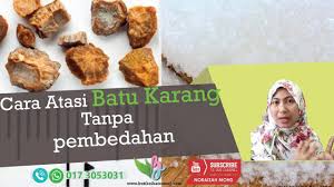 Batuk merupakan respon tubuh untuk mengeluarkan lendir, debu atau jerebu melalui saluran pernapasan. Cara Atasi Batu Karang Tanpa Pembedahan Youtube
