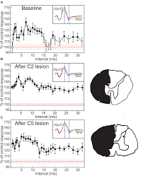But his mother, véronique, knows how obsessed her son really is with this sport. Frontiers A Re Evaluation Of Whether Non Monosynaptic Homonymous H Reflex Facilitation Tests Propriospinal Circuits Frontiers In Systems Neuroscience