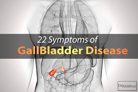 22 Symptoms Of Gallbladder Disease Drjockers Com Gallbladder Cancer Gallbladder Symptoms Gallbladder