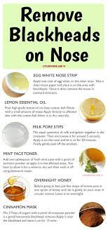 Pin By Nicole Rivera On Home Remedies Reduce Oily Skin Home Remedies For Acne Vitamin A Foods